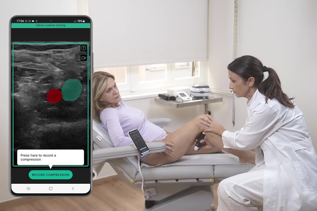 ThinkSono-Streamlines-POCUS-Training-with-AI-Powered-Software-clarius-iredeem-italy